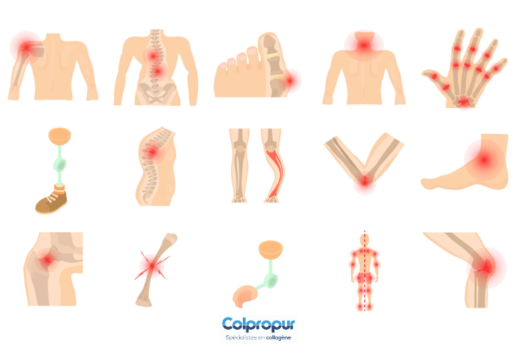 Le rôle du collagène dans les articulations